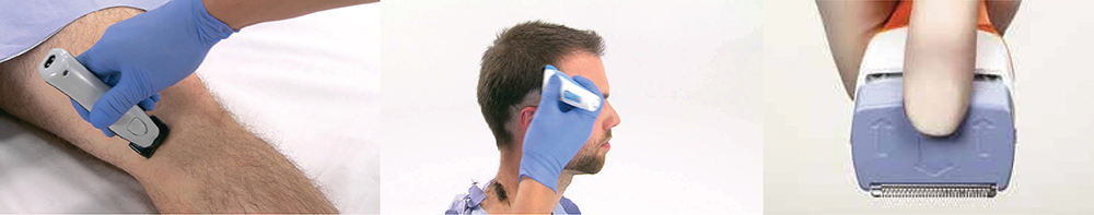 手术剪结构设计案例