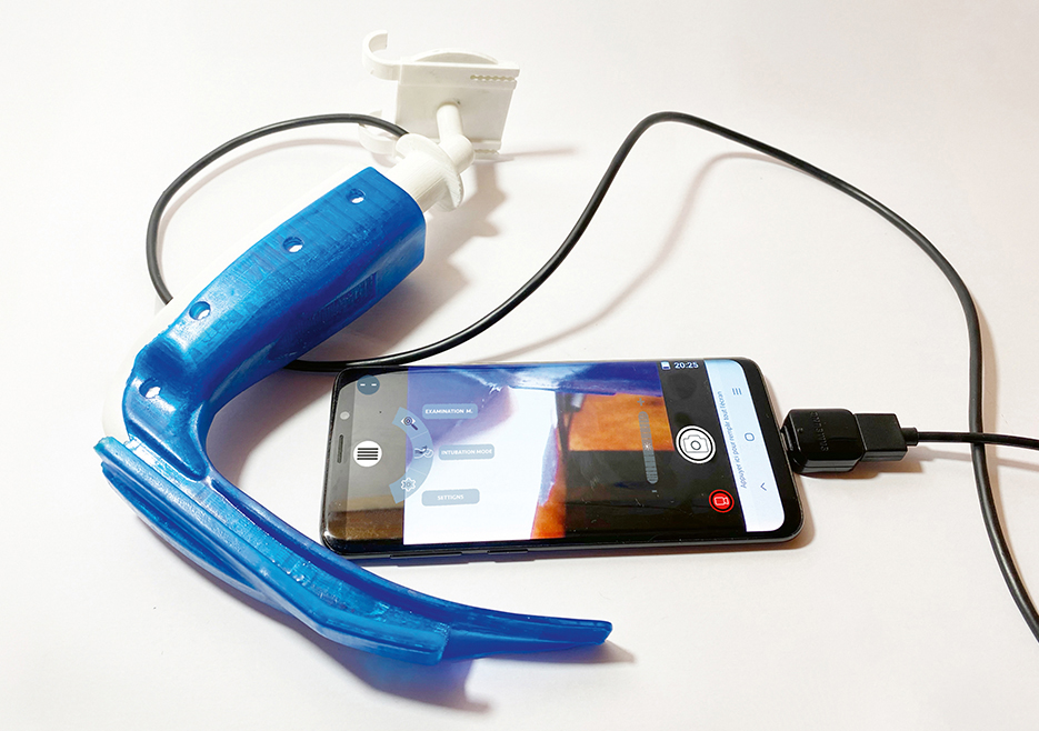 3D打印视频喉镜医疗产品外观设计方案要怎样脱颖而出